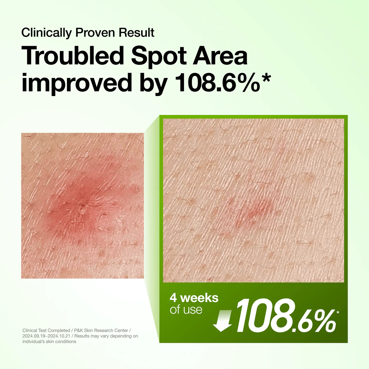 Anua Azelaic Acid 10 Hyaluron Redness Soothing Serum Сыворотка для лица 30 мл