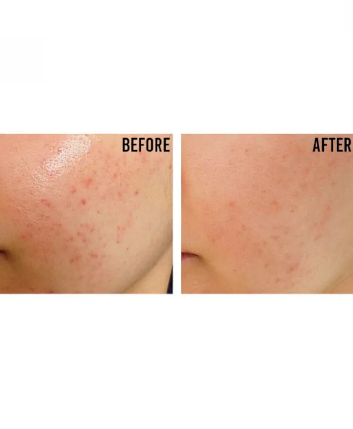 Beauty of Joseon Relief Sun: Rice + Probiotics 50+ PA++++ с Пробиотиками Günəşdən qoruyucu krem 50 ml