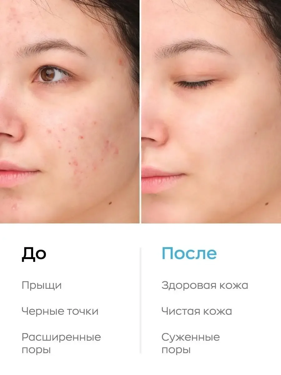 Likato Professional Cleansing Foam с Ниацинамидом, Цинком и Салициловой Кислотой Üz yuma köpüyü 150 ml