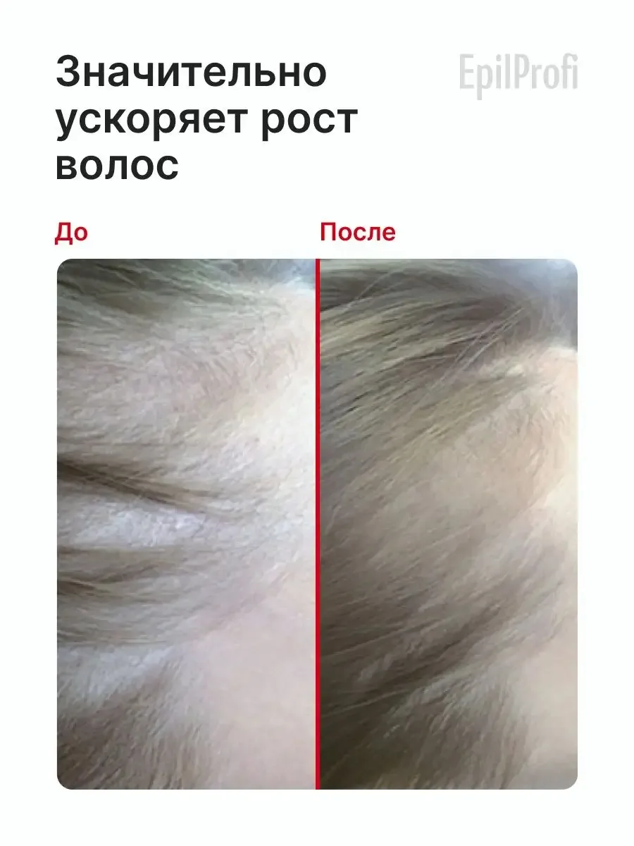EpilProfi Активатор Роста с Красным Перцем Маска для волос 500 мл