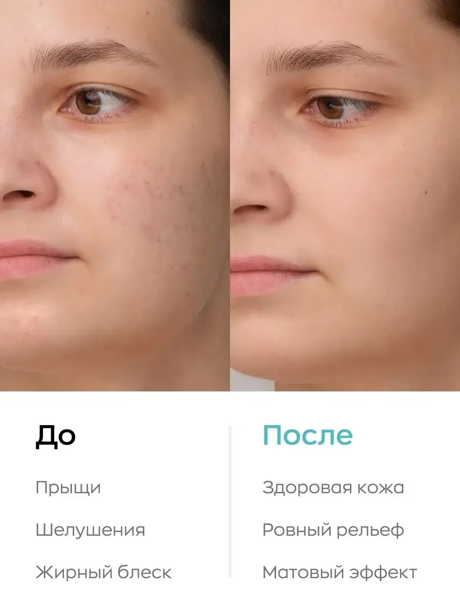 Likato Professional Face Lotion 2-Phase Двухфазный Увлажняющий для Lица с Цинком Lotion 200 ml