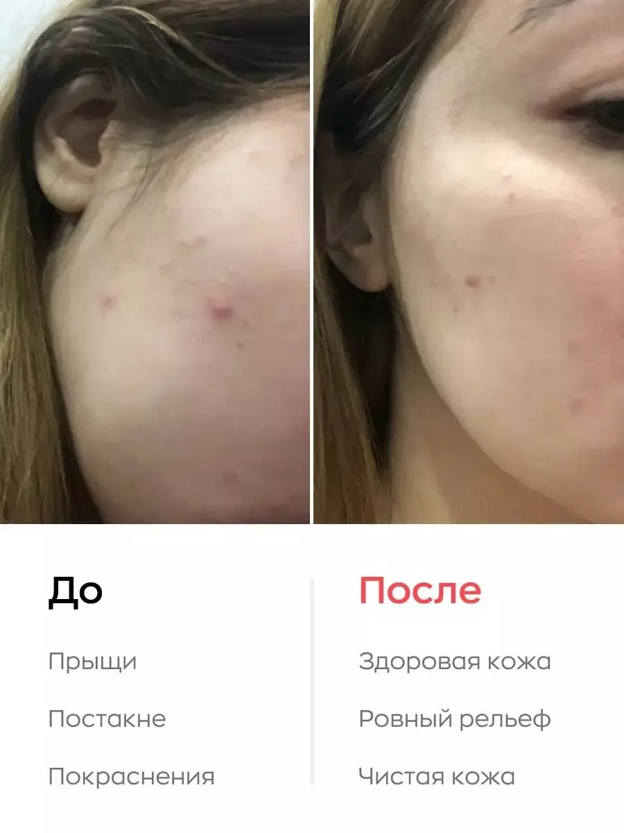 Likato Professional Sos Control Cream Üz kremi 20 ml