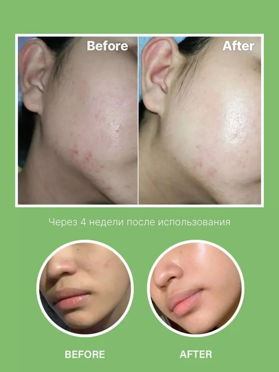 Celimax the Real Noni Energy Ampoule Serum 50 ml
