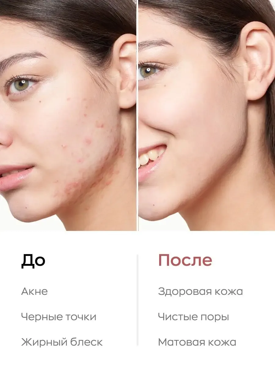 Likato Professional Face Serum с Ниацинамидом и Цинком Üz serumu 30 ml