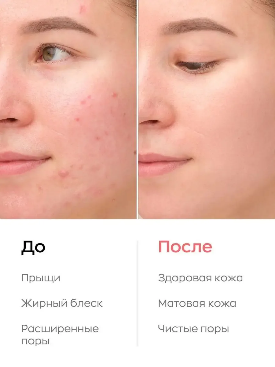 Likato Professional Akne Killer Face serum 30 ml