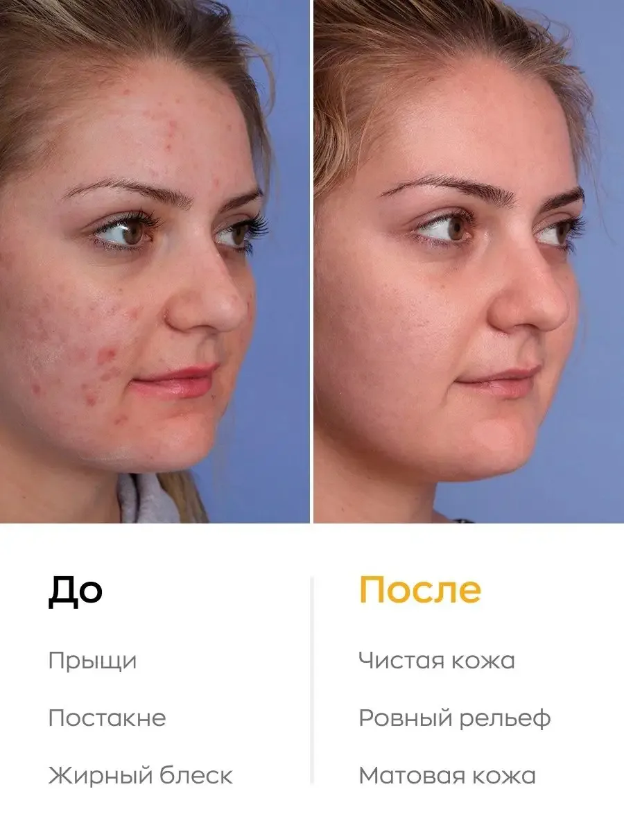 Likato Professional Face Cream Крем-Флюид для Lица с Ретинолом Акне-Контроль Üz kremi 50 ml