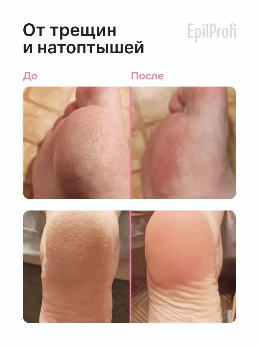 EpilProfi Foot Cream от Трещин и Натоптышей Крем для ног 500 мл