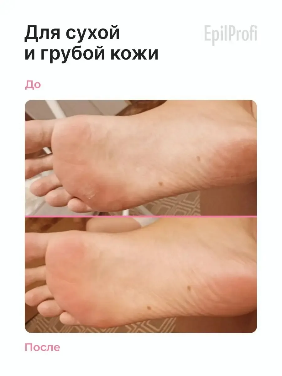 EpilProfi Foot Cream от Трещин и Натоптышей Крем для ног 500 мл